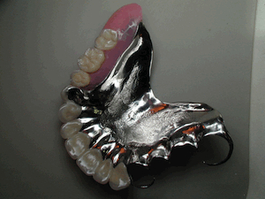 Dentiste Implants