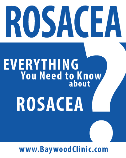 Rosacea